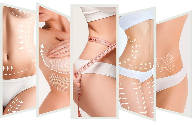 Fotona TightLase and TightSculpt